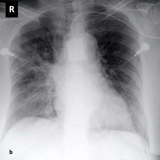 X-Ray image